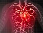 Cardiac Patient Care: Coronary Artery Disease (CAD) from Wild Iris Medical Education